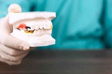 Close-up of a plaster dental model of the upper and lower jaws for diagnosis and treatment planning. Concepts of oral anatomy, dental restoration, and clinical care. © Tom