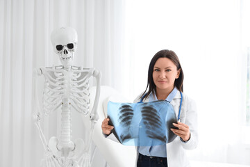 Female doctor with x-ray image of lungs in clinic
