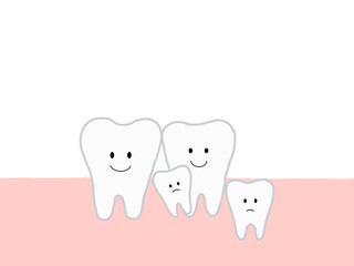 埋没歯・過剰歯による歯並びの乱れを表したイラスト