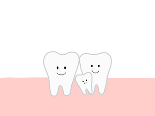 埋没歯・過剰歯による歯並びの乱れを表したイラスト