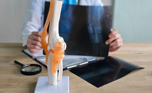 Doctor examines knee joint model while reviewing X-ray images
