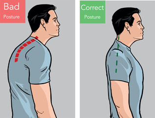 Comparison of man with good and bad back posture. Male suffer from scolisosis from sedentary work. Vector illustration.
