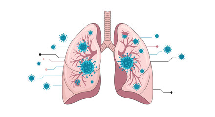 Medical diagram of human lungs infected with the coronavirus, showing the virus spreading through the respiratory system.