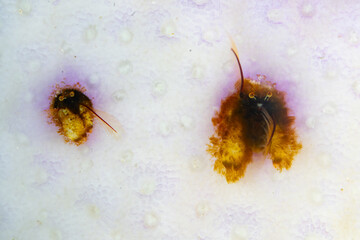A pair of tiny coral hermit crabs, Paguritta sp., live in a bleached coral on a shallow reef in Raja Ampat, Indonesia. These small crustaceans use their antennae to capture passing planktonic food. 