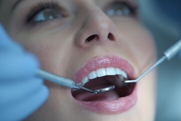 Dental checkup with dentist examining teeth