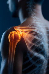 x ray image of a shoulder painful shot