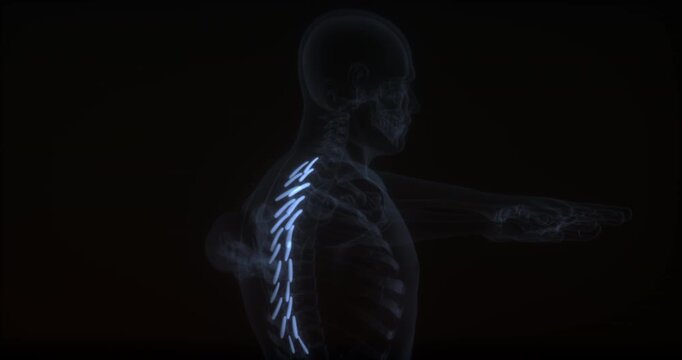 Levatores costarum muscles in human body. X Ray