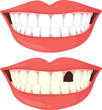 Dental health and missing teeth illustration