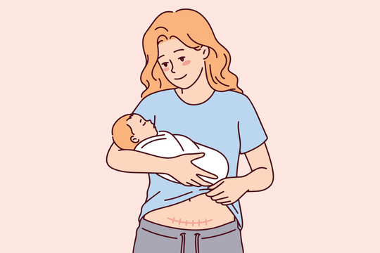 Proud woman cradles her infant child and looks down at surgical incision on her belly. Reality of motherhood and postpartum recovery after cesarean section delivery in hospital or at home.