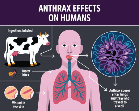 Anthrax Effects On Humans Infographic Showing Transmission And Lung Infection vector illustration