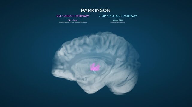 Parkinson Dopamine Loss Basal Ganglia Pathway Dysfunction on Blue Background