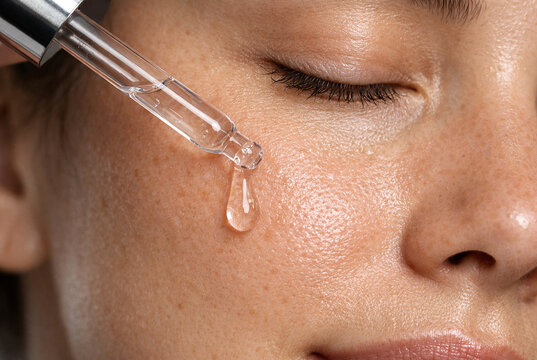 A high-quality, clinical close-up photograph of a woman&rsquo;s face with freckles as a glass dropper applies a clear, hydrating liquid serum to her cheek, perfectly highlighting professional skincare treat
