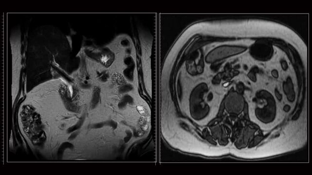 Radiology MRI Animation Displaying Internal Metabolism