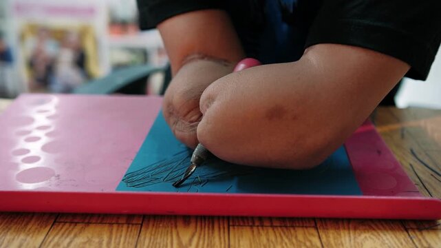 Disabled artist without fingers meticulously carving a design on a linoleum block showcasing resilience, adaptation and passionate printmaking craft.