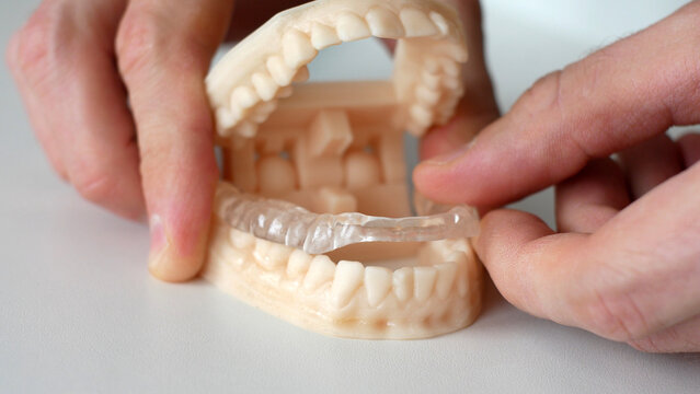 Close-up of male hands inserting a splint into a polymer model of a human jaw