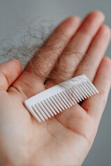 Naklejka premium Hair loss acceptance and identity reconstruction .