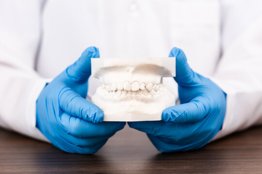Orthodontic treatment planning with dental plaster model, dentist analyzing upper and lower jaw malocclusion, modern clinical dentistry concept.