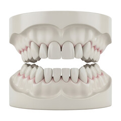 White Plaster Dental Cast Model of Human Teeth for Orthodontic Laboratory Training isolated on transparent background