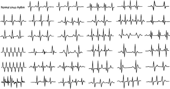 Electrocardiogram ECG Tracing Normal Sinus Rhythm Medical Line Art Vector Illustration