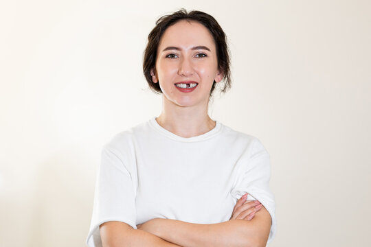 Mature Caucasian brunette woman missing a front tooth. Adult toothless woman