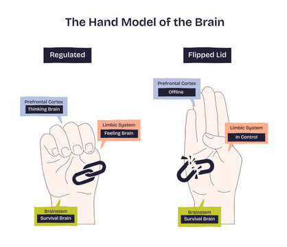 Hand brain model contrasts regulation vs flipped lid with fist and open hand, shows prefrontal cortex, limbic system, brainstem, and a broken link symbolizing disconnection. Diagram