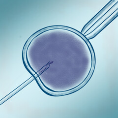 In vitro fertilization and assisted reproductive technology concept. Medical illustration of ivf process where the needle injects sperm into an egg. transparent, isolated
