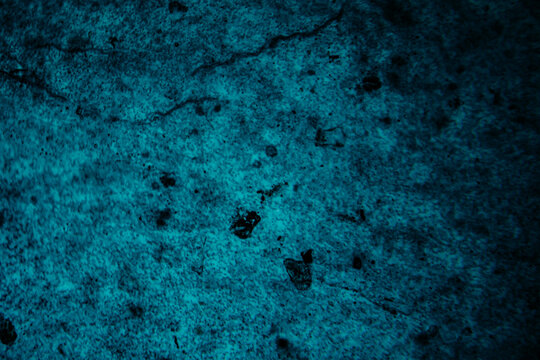 A high-magnification fluorescence microscopy image of a tissue sample showing cellular structures in varying shades of blue with darker, clustered areas.