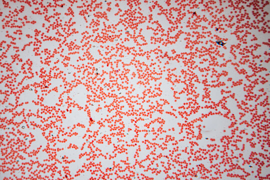 Microscopic image showing a dense field of red blood cells (erythrocytes), stained bright red and scattered throughout the slide. The cells are biconcave and uniform in shape, typical of healthy human