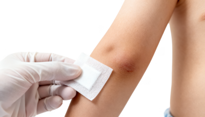 Sterile gauze pad carefully positioned on a childs arm lump by a healthcare professional emphasizing gentle postcare wound protection on white backdrop.