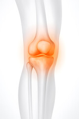 Medical illustration showing knee pain and inflammation