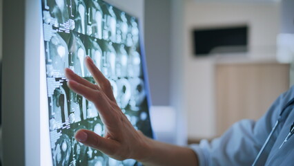 Closeup radiographic bones visualization on screen. Professional studying scan