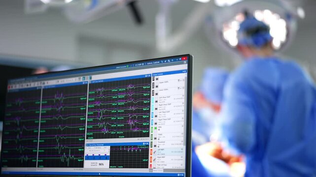Computer screen with brain waves. Close up. Uniformed doctors perform neurosurgery at blurred backdrop.