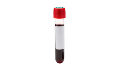 Single blood test tube for liver function testing placed beside a lab clipboard with a blank form isolated on white to focus on diagnostic preparation and paperwork.