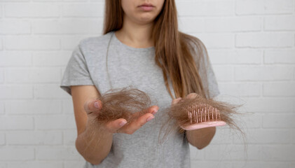 Sad woman holding clumps of fallen hair and a brush, severe alopecia