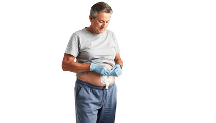 Middleaged individual confidently replacing colostomy pouch using sterile techniques highlighting independence and hygienic home care practices.