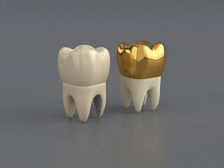 Dental crowns with golden and ceramic finish