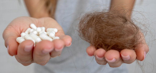 Hair loss and vitamins: woman holding clump of lost hair and white capsules