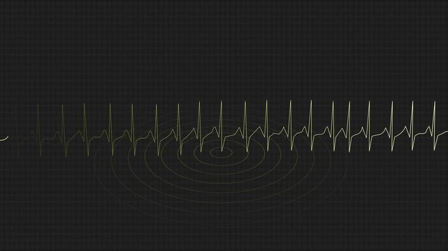 Digital concentric seismic waves, symbolizing monitoring and early warning systems. Disaster preparedness, geophysical research technology, and emergency communication concepts on black background.