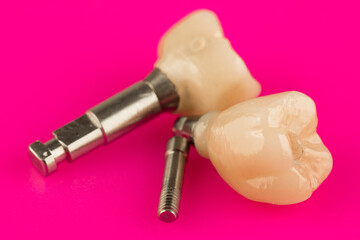 ceramic dental crown for fixation on a dental implant
