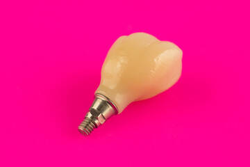 ceramic dental crown for fixation on a dental implant