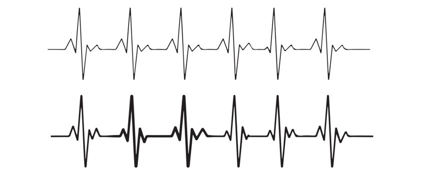 abstract representation of a heartbeat rhythm displayed as a dark waveform against a plain white background silhouette