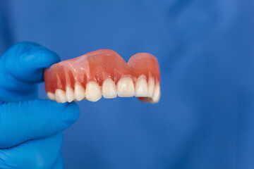 Dentist's hand holding a complete upper jaw denture. Concept of dentistry, oral health, oral rehabilitation, prosthetic treatment, and tooth replacement in a clinic. © Tom