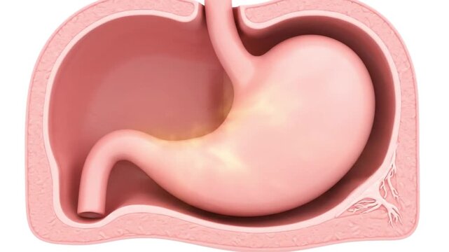 Animated human stomach with highlighted inflammation area, medical illustration, digestive system, stomach lining, inflammation