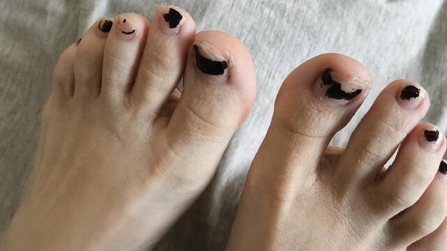 Chipped, worn black nail polish on his toenails. Spoiled pedicure on the legs. Podology