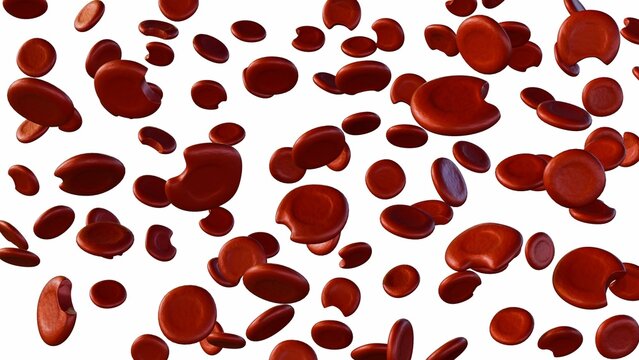 3D rendering of degmacytes, known as bite cells. It illustrates the specific morphological changes when erythrocytes undergo oxidative damage.