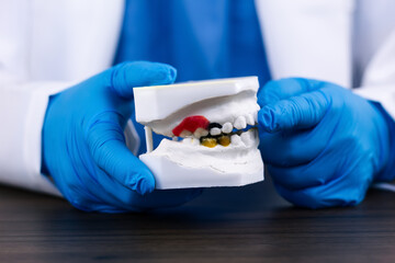 Dental surgeon analyzes study model plaster cast of upper and lower jaw, planning oral surgery, diagnosis of mandibular pathology, surgical treatment, clinical dental precision technique