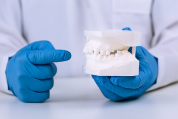 Orthodontist evaluating dental malocclusion using a plaster model of upper and lower teeth for biomechanical study, diagnosis, treatment, and bite alignment at a professional dental clinic. Close-up.