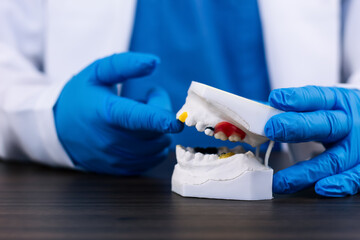 The dentist's hands show a dental model plaster cast of the upper and lower jaw, diagnostic study, treatment planning, orthodontics, braces, and dental correction.