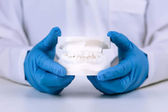 Visual diagnosis in advanced dentistry. A three-dimensional plaster model of the mandible is shown for treatment planning and detailed study of modern oral health.