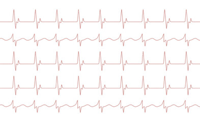 A repeating pattern of electrocardiogram heart rate lines on a white background.